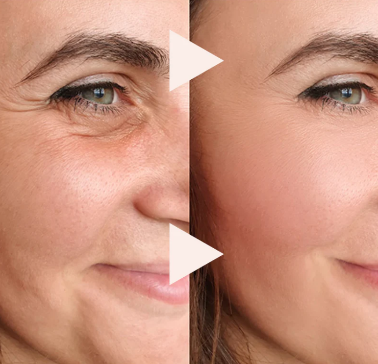 Quicklift Anti-Wrinkle Oil